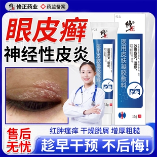 眼皮癣神经性皮炎眼皮红肿痒眼睛周围过敏发痒眼角干燥起皮掉屑VQ