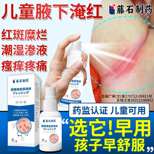 胳肢窝淹红湿疹渗液瘙痒疼痛