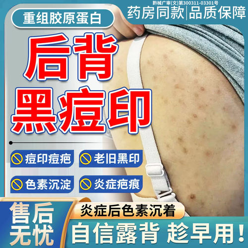 后背痘印色素沉淀胶原蛋白医用