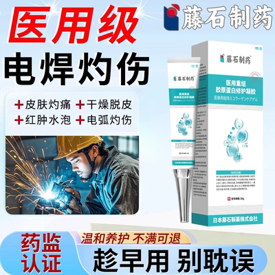 电焊工脸灼伤发红干燥脱皮烫伤膏