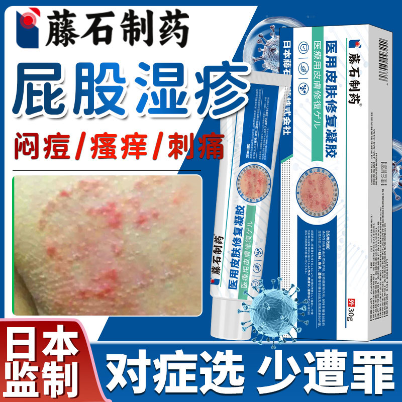 【藤石制药】屁股热毒湿疹止痒膏