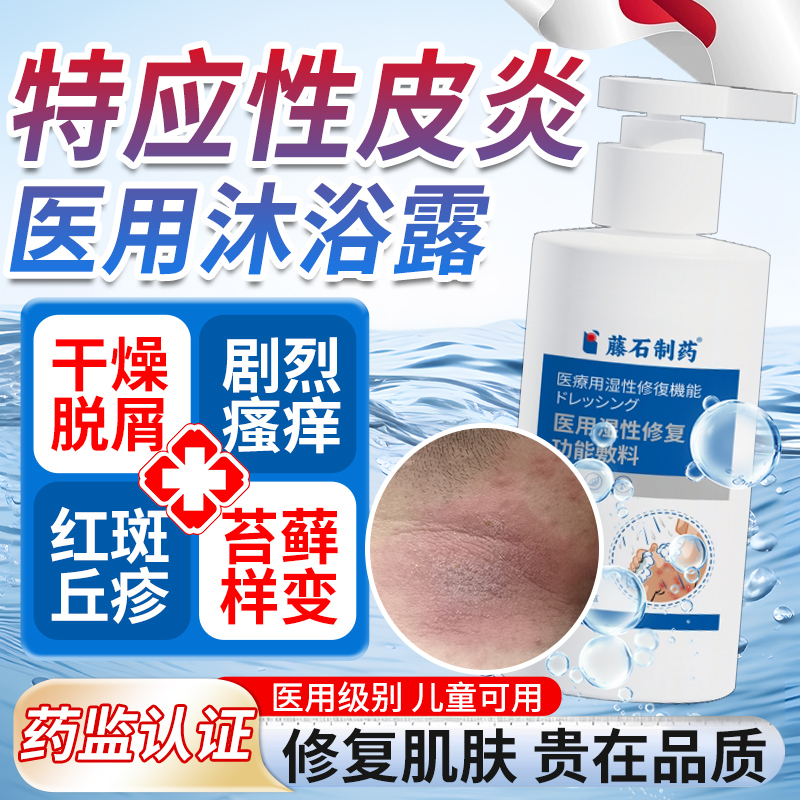 干燥脱屑瘙痒红斑修复肌肤屏障