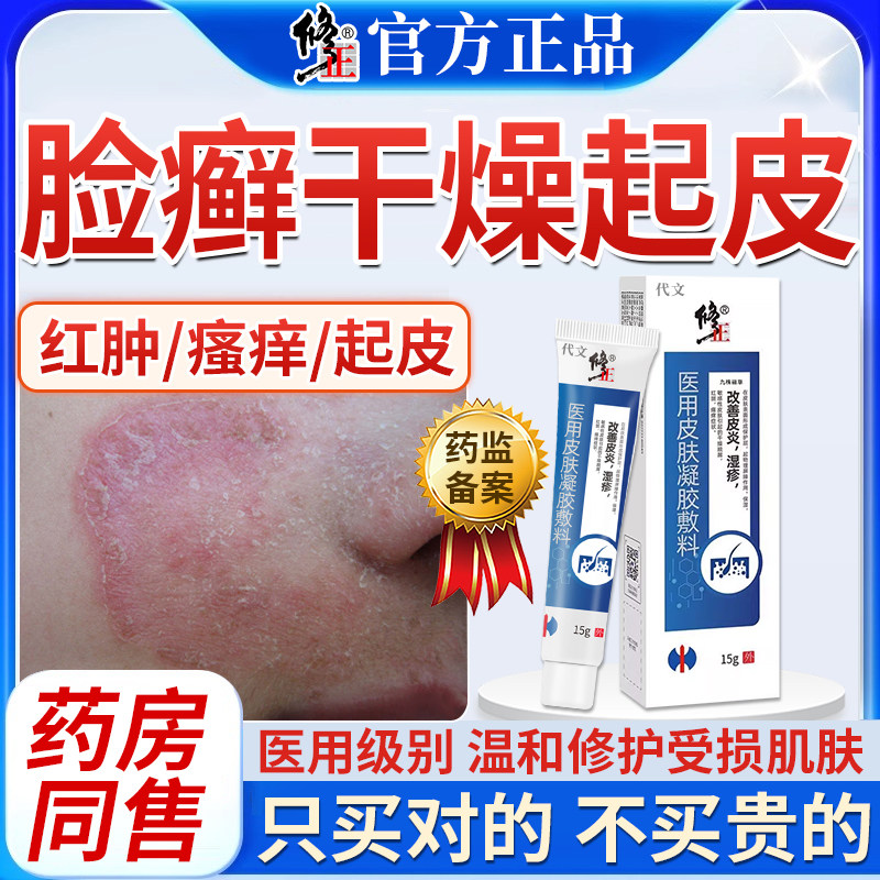 脸上长癣红肿皮肤干燥起皮真菌感染专用皮肤癣痒外用药房同售膏WQ