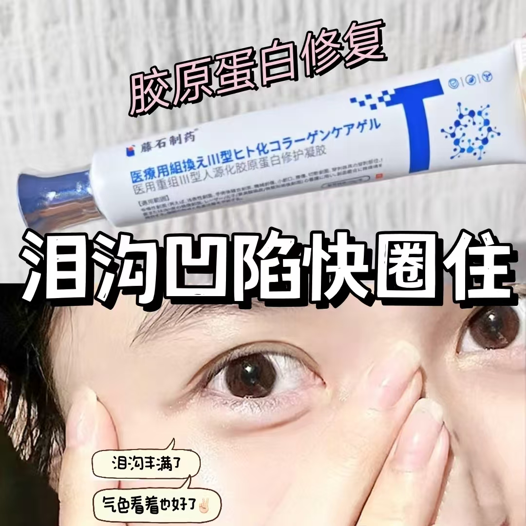 泪沟法令纹填充面部凹陷凝胶