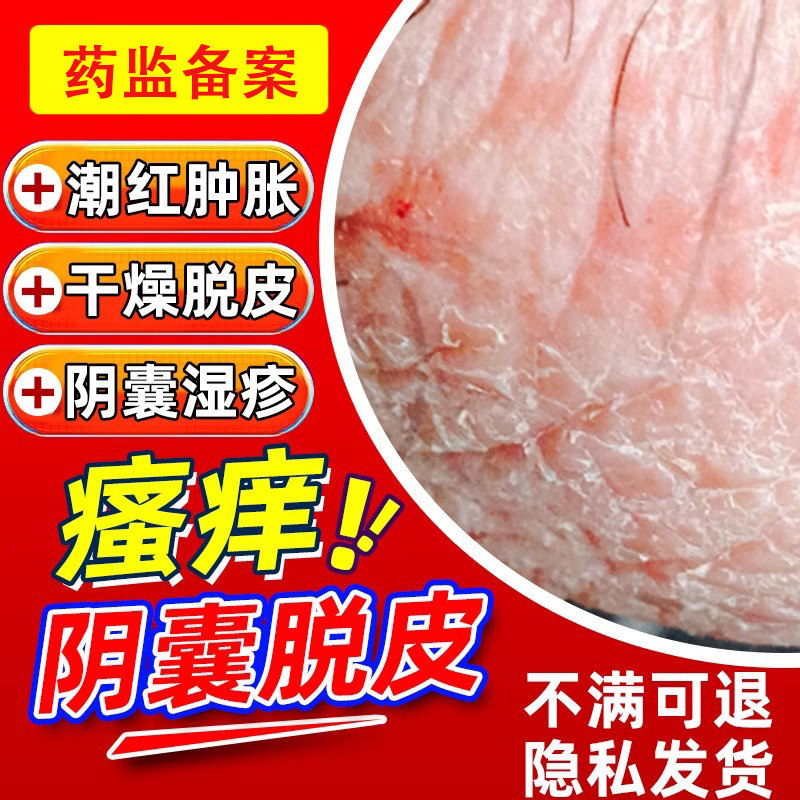 阴囊痒睾丸瘙痒脱皮湿疹止痒癣瘙痒阴囊私处男大腿内侧真菌感染aa
