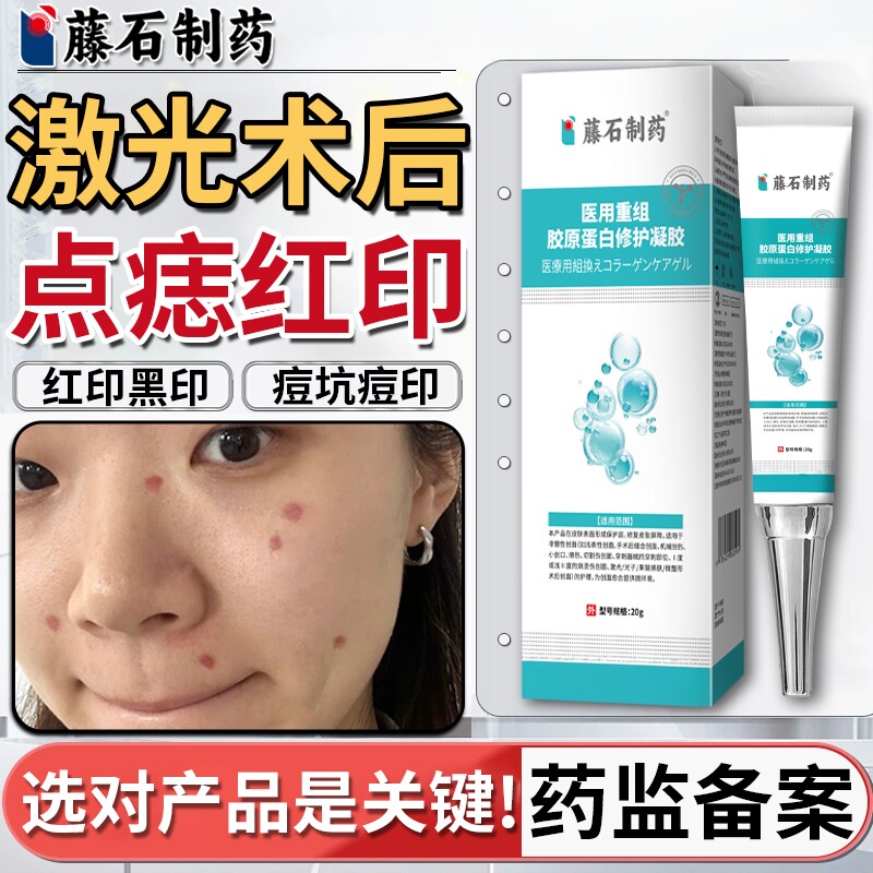 激光点痣后红印去黑印修复凝胶图片