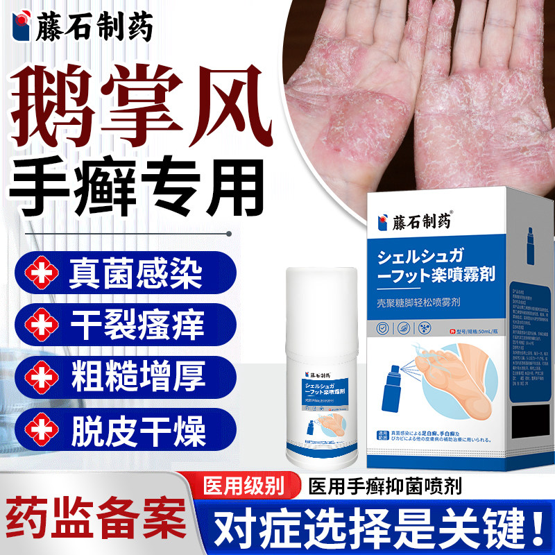 鹅掌风专用可搭治疗手癣藓手掌干裂脱皮开裂真菌感染膏药房同售DS
