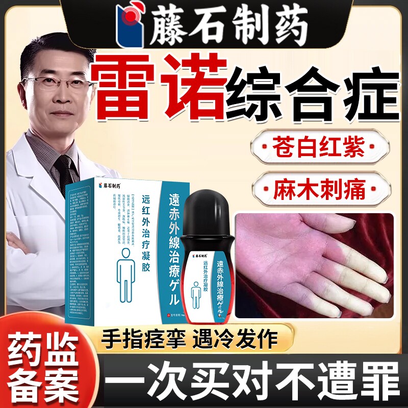 雷诺氏病综合症征软化手指硬皮病雷诺现象受冷苍白麻木刺痛溃烂YZ