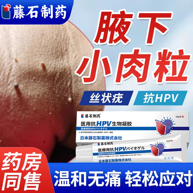 腋下小肉粒丝状疣去除神器疣瘊皮赘专用软疣体脱落根药房同售膏WQ