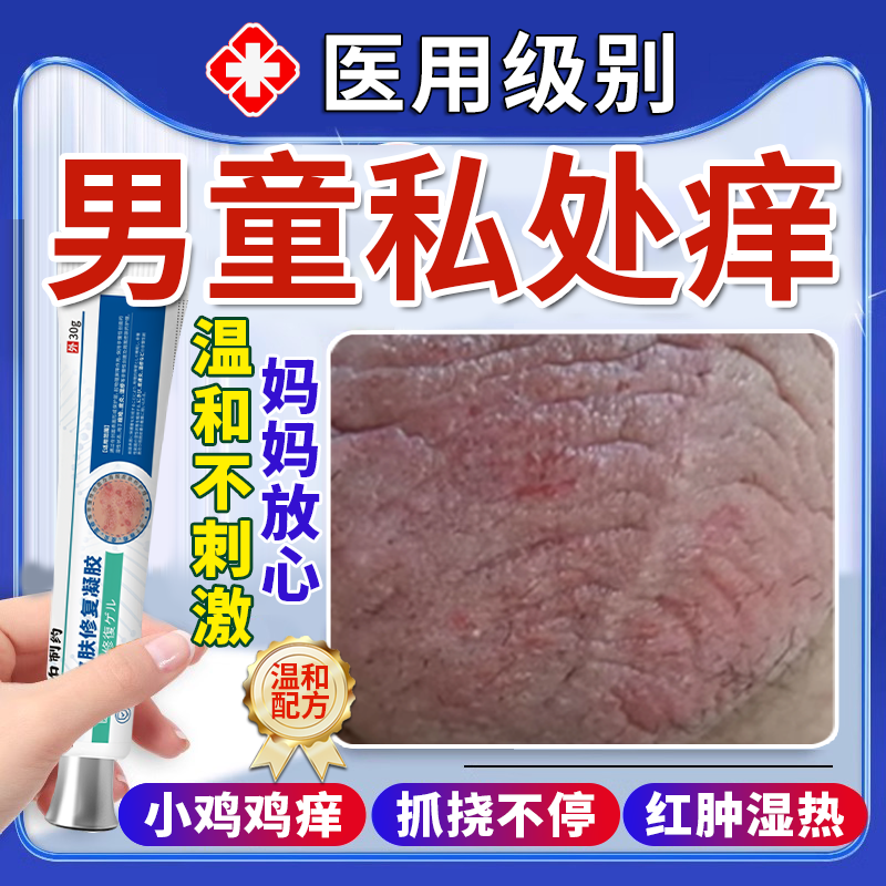 儿童小鸡鸡裆部蛋皮瘙痒阴囊潮湿出汗男人专用去止痒根药房同售VQ