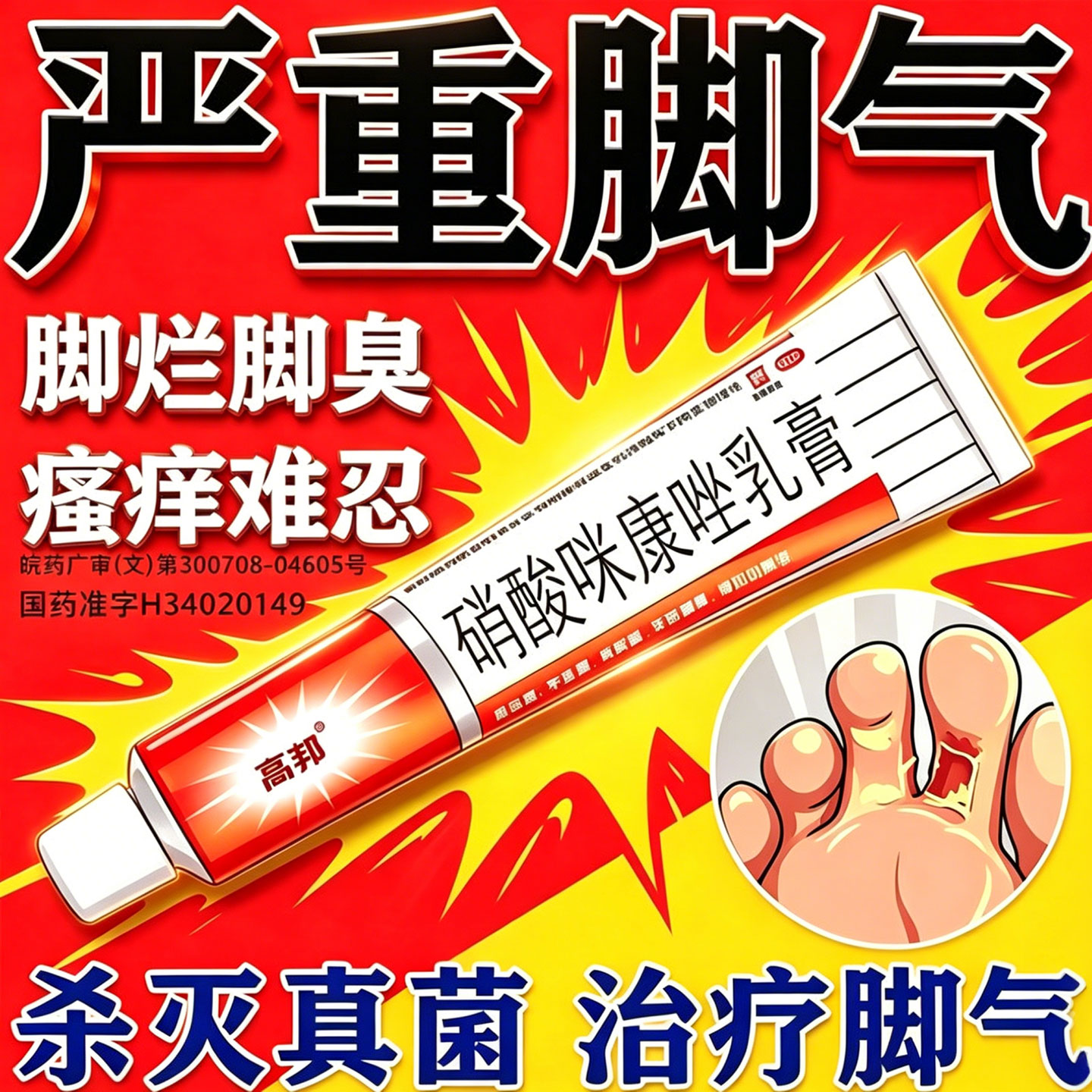 硝酸咪康唑乳软膏正品脚气烂脚丫药止痒脱皮糜烂脚趾缝软膏杀菌