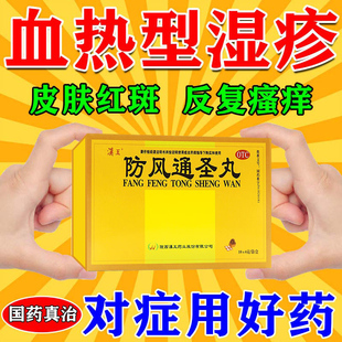 防风通圣丸中成药寻荨麻疹湿疹过敏止痒断非根去仲景防风通肾丸ql