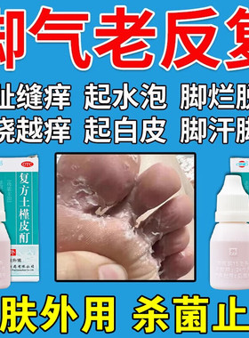 恒健复方土槿皮酊包邮钉汀盯士槿土丁町瑾懂荆木土皮槿酊非白云山