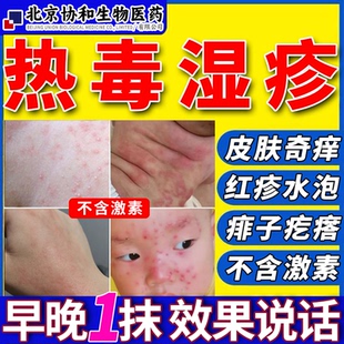 熱毒藥膏濕毒清去火毒癢寧根克星苗醫苗方皮膚高溫濕疹痱子止癢QY
