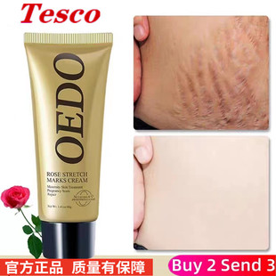 Cream Anti Care Stretch Oil Skin Mark Firming Removes Aging