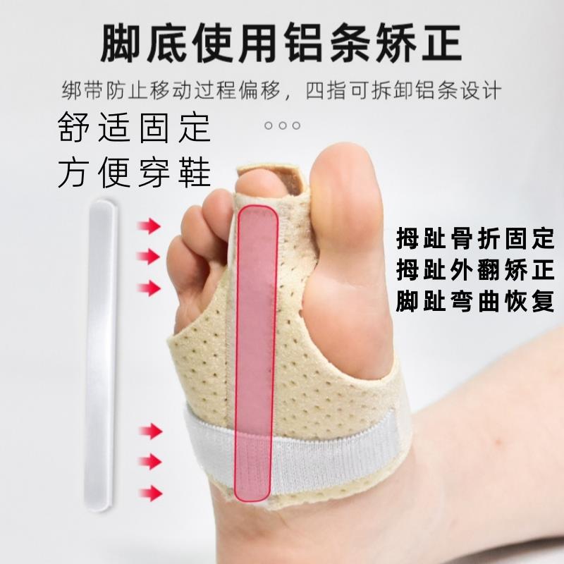 脚趾骨折防扭伤固定器大拇指外翻矫正护具大脚骨突出分趾固定夹板