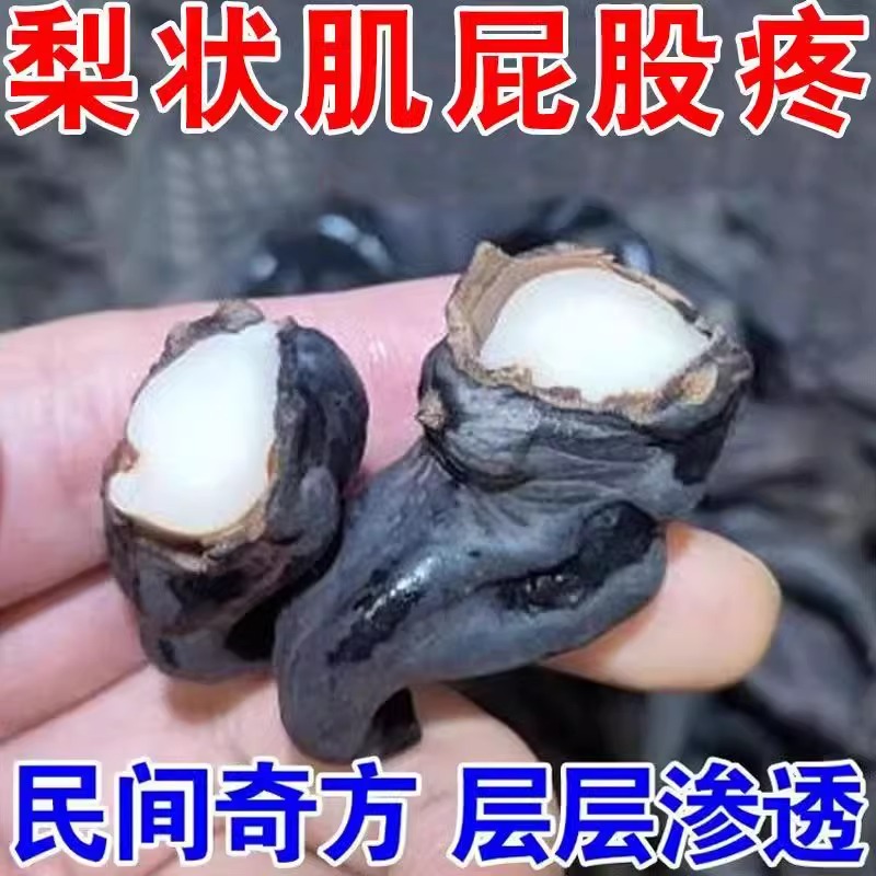 秘方】梨状肌综合症特效药治疗腰椎压迫坐骨神经腿疼屁股疼膏药贴