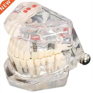Tooth model model dental care model denture dentist Dental D
