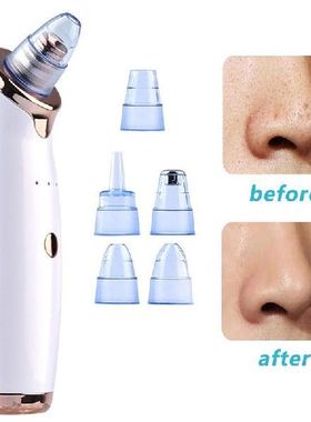 Electric Facial Pore Cleaner Blackhead Blemish Remover