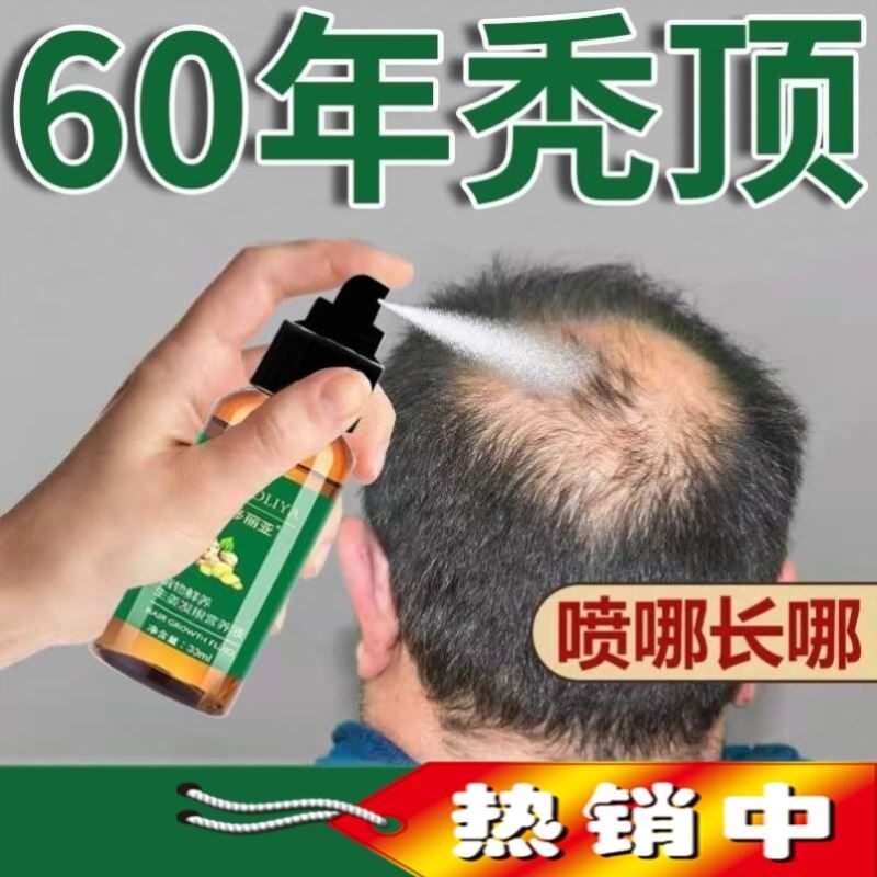鬼剃头斑秃片状脱发掉发头顶快速增发密发斑秃