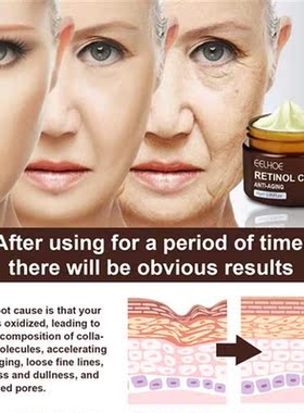 Retinol Wrinkles Removal Cream Anti Aging Firming Lifting Sk