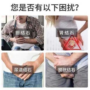 方净石王公多发蒲英鸡内金片古KTY小便性刺痛