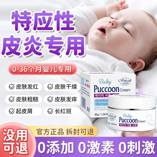 特应性皮炎婴儿童身上皮肤湿痒无激素痒非药特效止瘙干性湿止痒膏