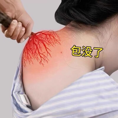 富贵包消除特i效i药膏贴正品颈椎富贵包消除神器专用矫疏通按摩器