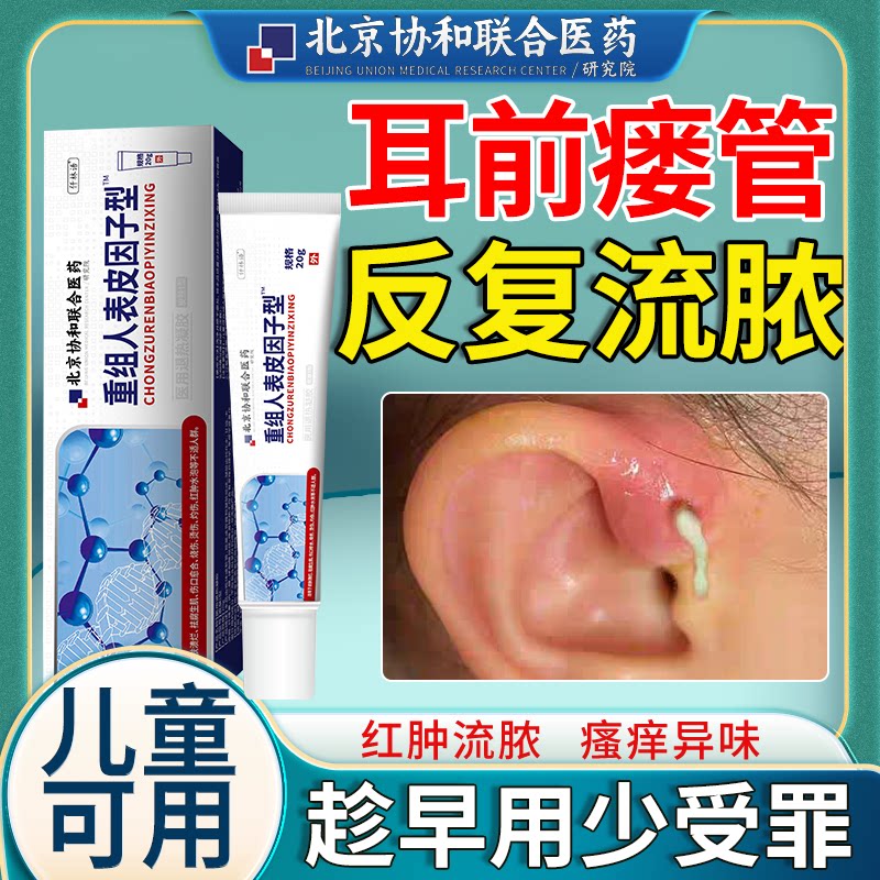 耳前瘘管红肿鼓包耳仓发炎流脓先天性耳前瘘管防水贴可搭药膏ik