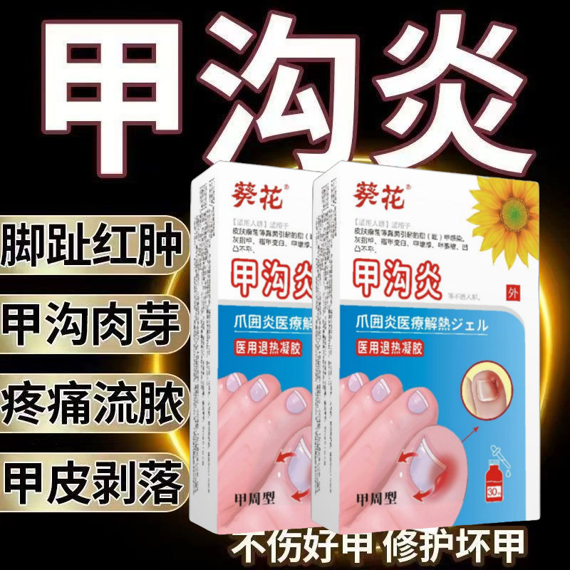 【无痛感】甲沟炎神器脚指甲发炎疼痛嵌甲甲沟红肿疼痛指甲长肉里