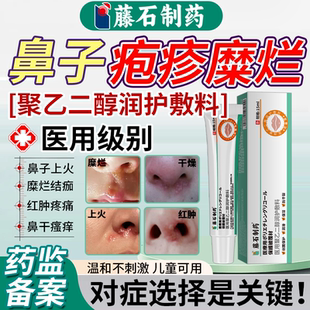鼻子上火起泡疱疹红肿上嘴唇口唇烂嘴角发痒病毒感染药房同售膏VQ