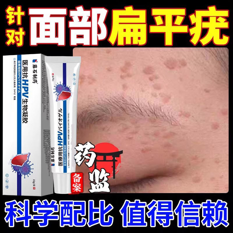 脸上扁平疣肉粒疙瘩去除hpv引面颈部疣扁皮疣优扁平丝状猴尤膏VQ
