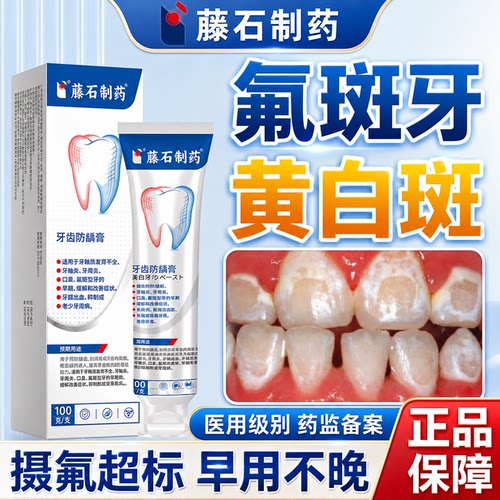 藤石制药-氟斑牙-黄白斑块