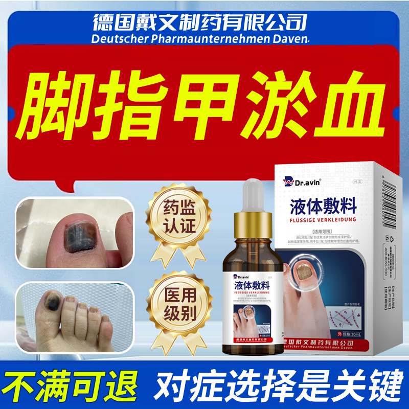 Dr.avin脚趾甲淤血发黑发紫