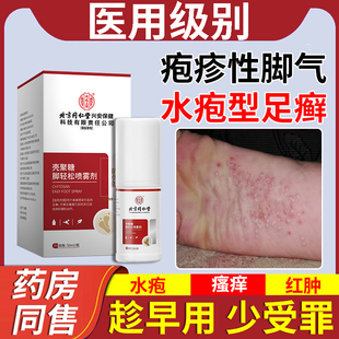 疱疹性脚气足癣膏烂脚丫专用脚趾缝脱皮痒糜烂真菌感染药房同售DS