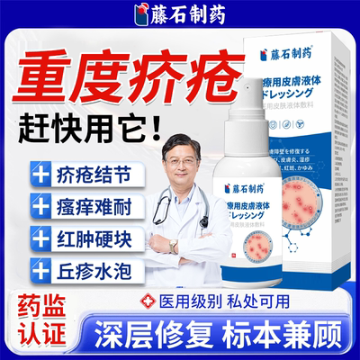 疥疮结节瘙痒难耐快用它