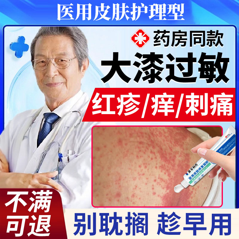 大漆过敏红肿痒专用拔毒抗敏