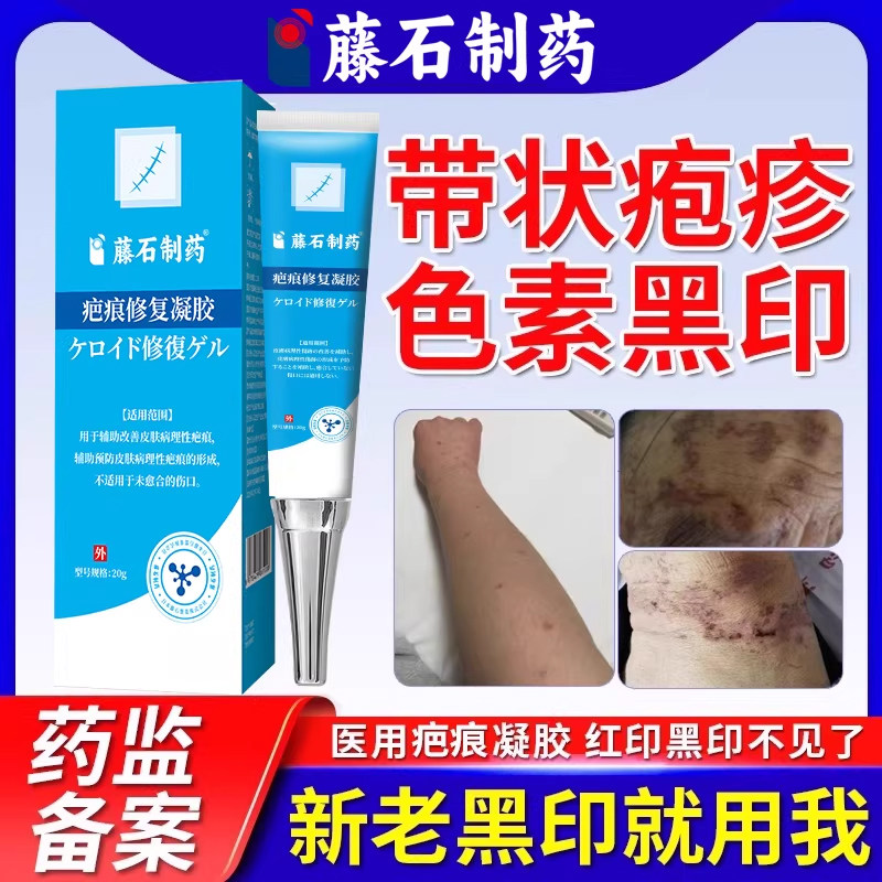 带状疱疹黑印色素沉着疤痕淡化凝胶瘢痕沉淀红印祛去疤印单纯性WQ