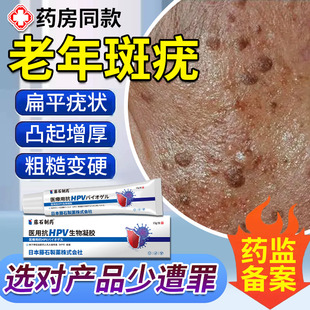 脸上扁平疣专用老年斑增厚凸起老人疣专用一抹灵脸部黑斑去除膏TU