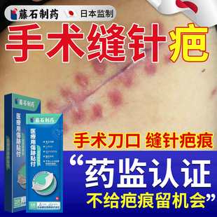 缝针疤痕修复除疤膏手术伤口刀口祛疤贴剖腹产后专用甲状腺术后DS