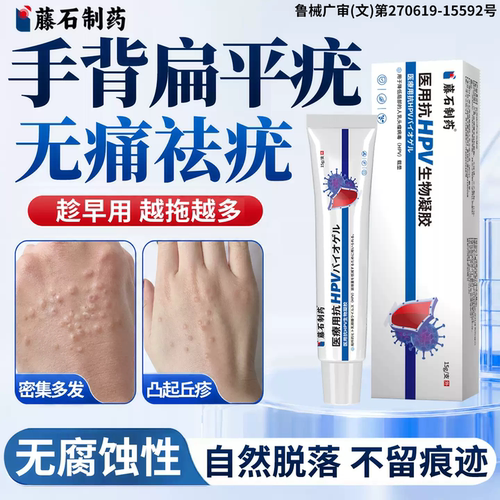 藤石制药医用祛丝状疣瘊去小肉粒