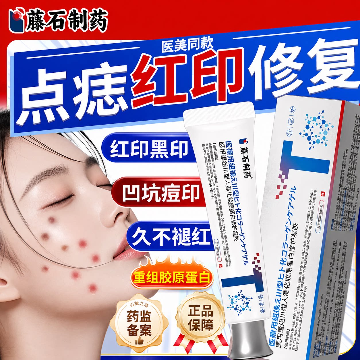 激光点痣祛斑后去红印黑印修复膏图片