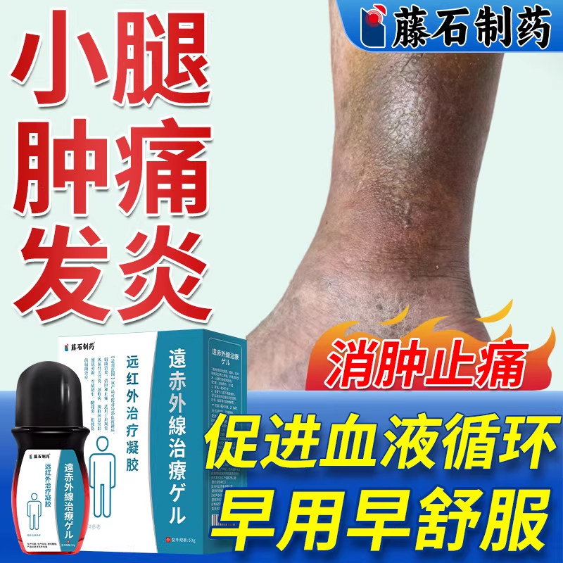 静脉曲张小腿发黑色素沉着脉管炎下肢静脉血栓药房同售膏喷雾剂WQ