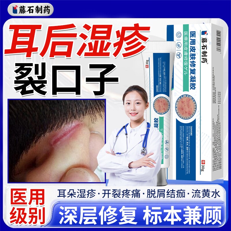 耳朵湿疹耳根开裂裂口耳垂外耳道耳背破溃渗液真菌感染药房同款DS