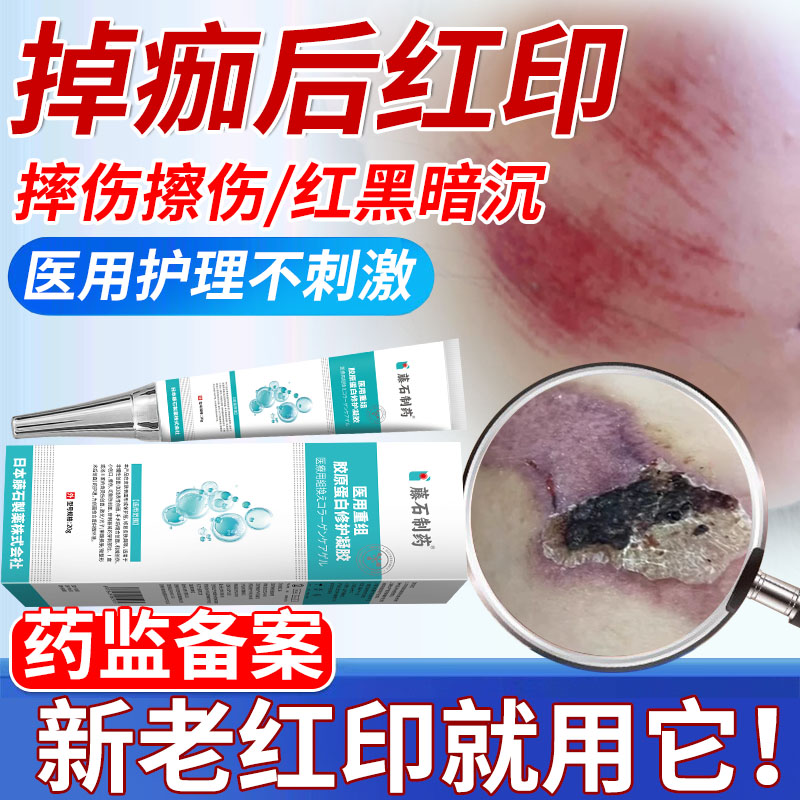 【医用护理】掉痂后红印疤印去除