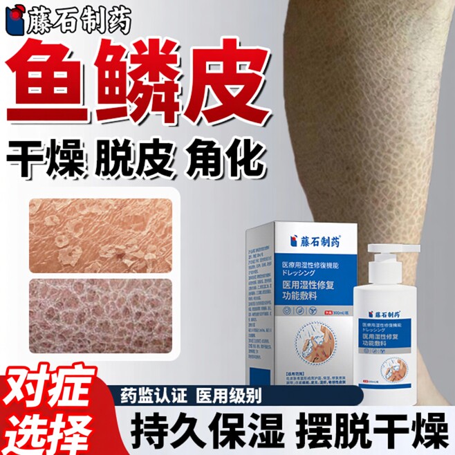 鱼鳞病蛇皮肤霜专用腿痒小腿皮肤干燥瘙痒止痒身体乳药房同款HT