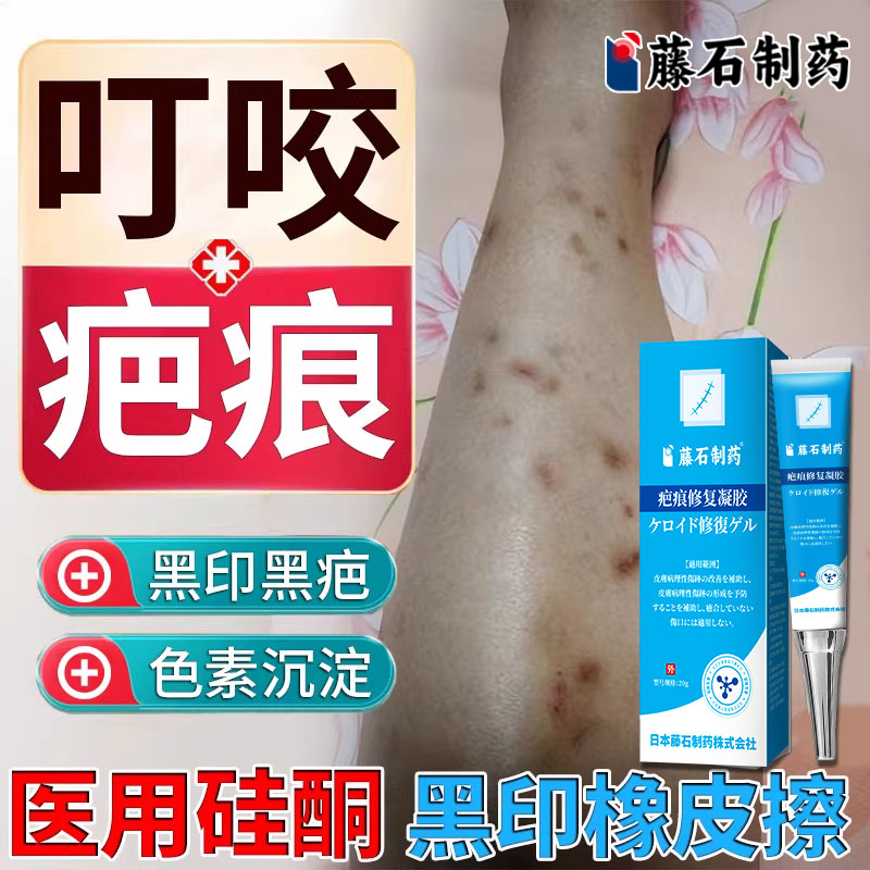 医用硅酮去蚊子疤印【儿童可用