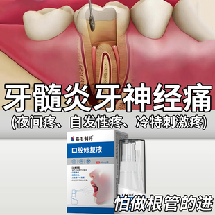 牙髓炎牙神经疼痛专用喷雾剂止疼牙疼牙痛漱口水止痛药房同售WQ