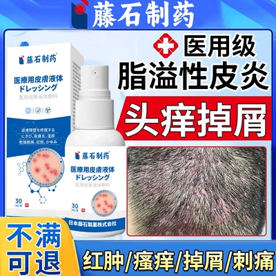 温和不刺激--头皮脂溢性皮炎喷剂