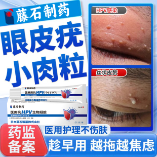 眼皮上长小肉粒丝状疣去除神器专用膏去脸上疙瘩根扁平疣面颈部DS